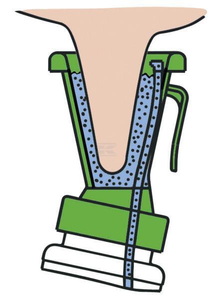 Steildipper Non-Return
