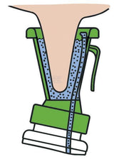 Steildipper Non-Return